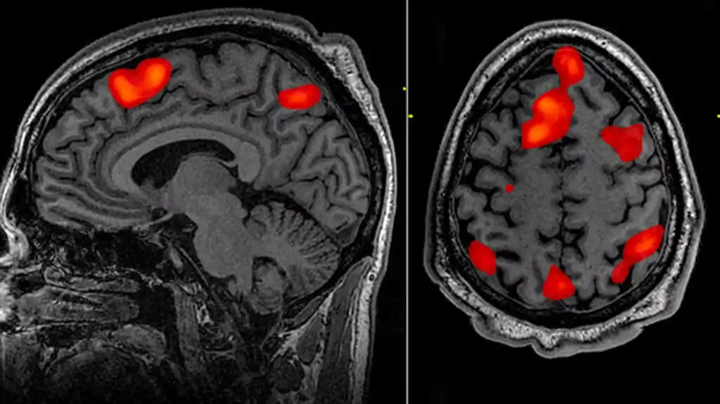 How Neuroscience and Data Science Interact